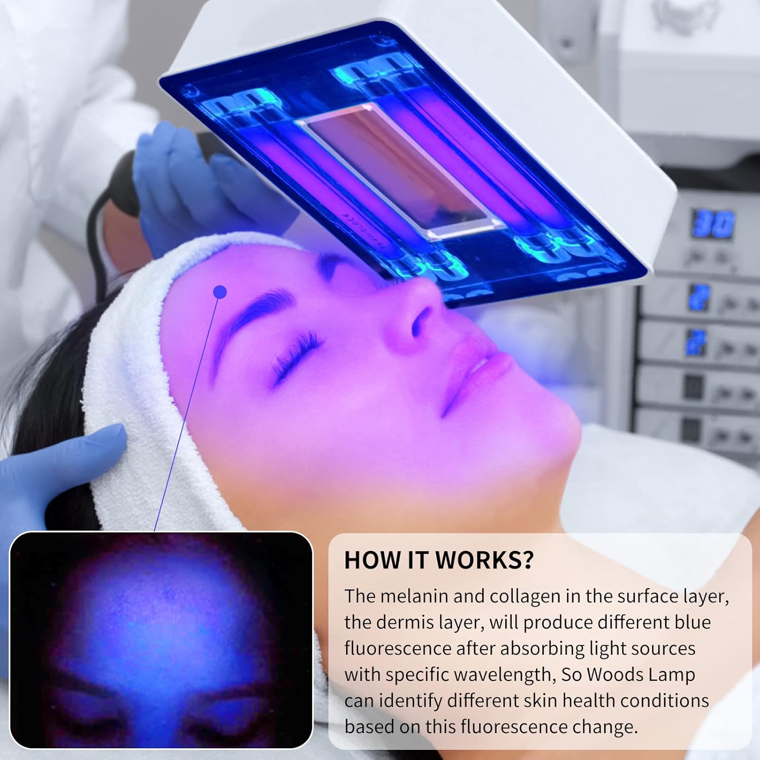 Woods Lamp Skin Analyzer,Magni - Lighting Jockey 리뷰 및 가격